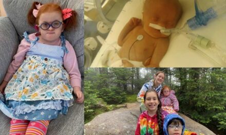 Sajjona’s Story: Six-Year-Old With Trisomy 18 Is Thriving