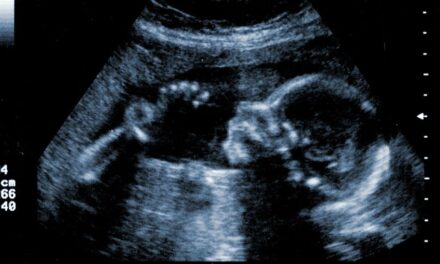 4D Chess: Baby About To Be Aborted Claims Squatter’s Rights