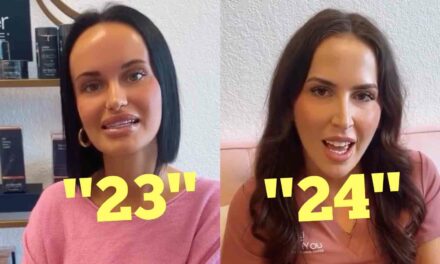 People can’t believe how old the women look in this viral Botox video 😬
