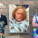 Michigan boy, 8, saves sister, 6, from near-fatal dog attack