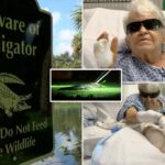 7-foot Florida gator takes chunk out of woman’s leg as she walks her dog