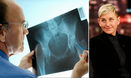 Ellen DeGeneres has osteoporosis: Here’s what to know about the painful bone condition