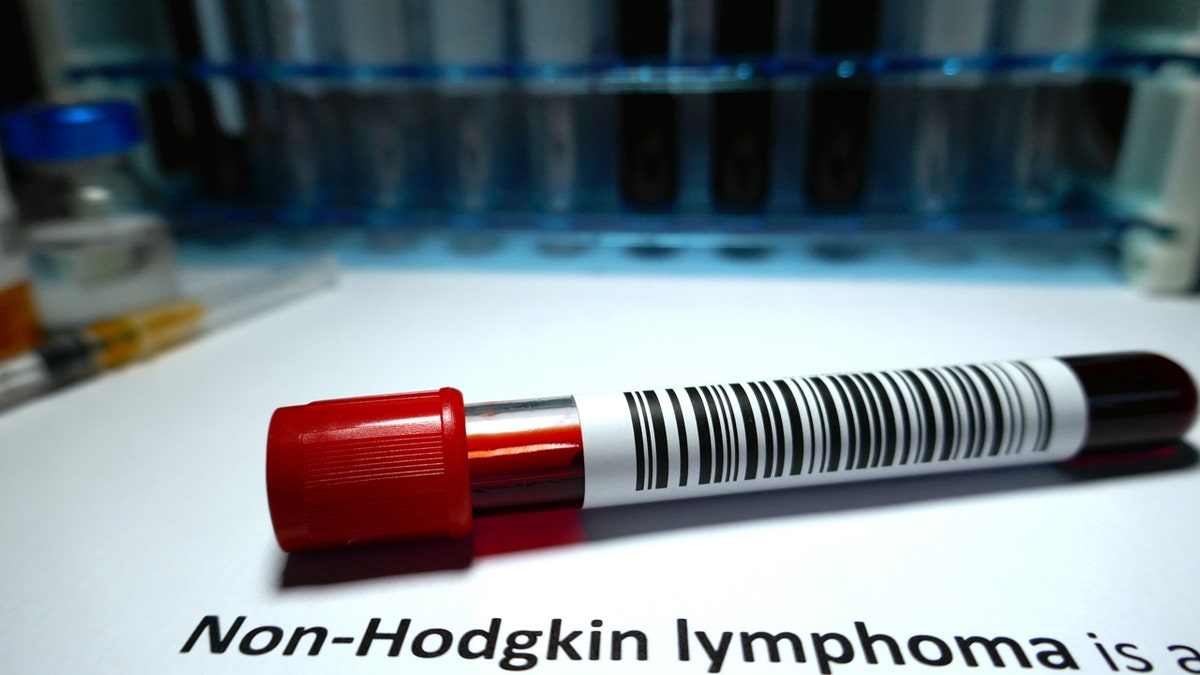 Test tube for non-Hodgkin lymphoma