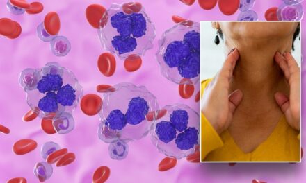 Lymphoma signs, symptoms, common treatment options for the blood cancer