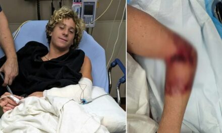 Florida teen surfer attacked by shark, says it ‘could have been so much worse’