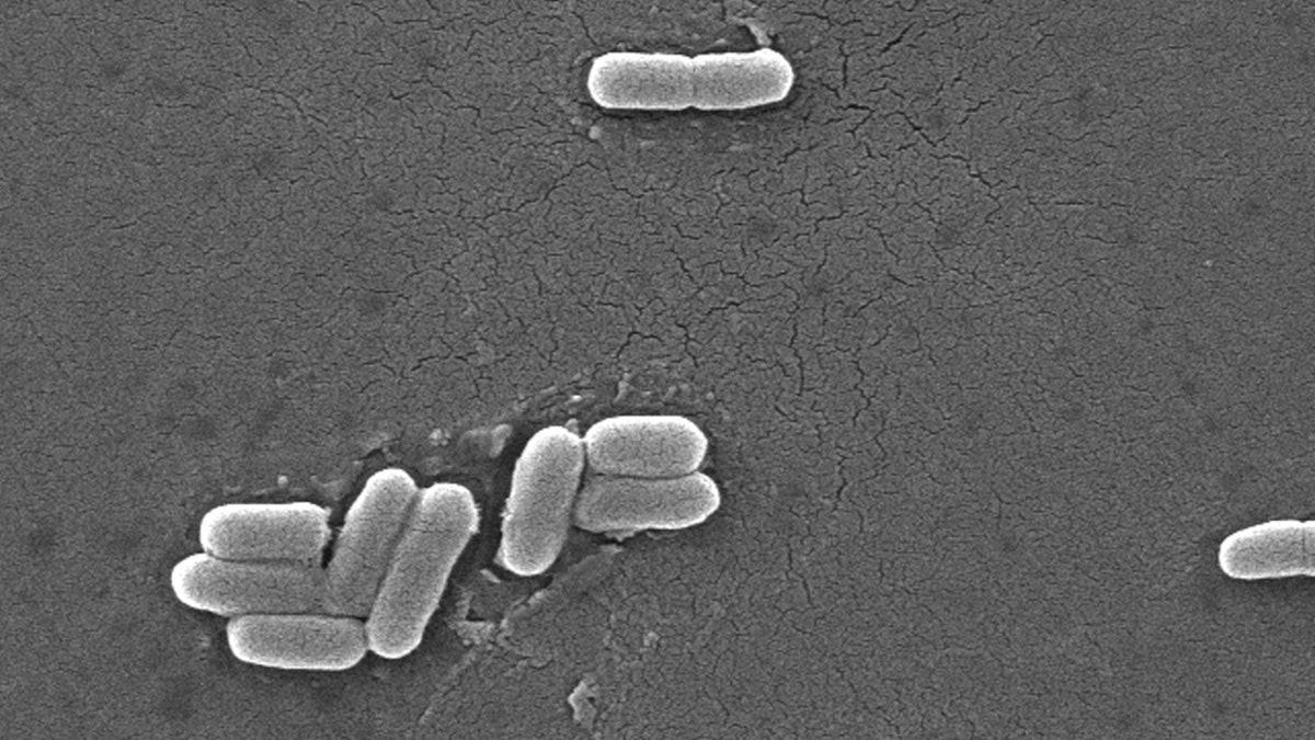 E. coli bacteria sample