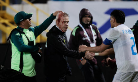 Mexican Soccer Manager Bloodied By Thrown Beer Can