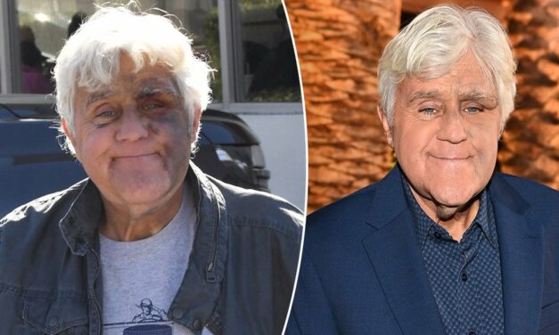 Jay Leno ‘feeling good’ despite suffering bruised face from fall