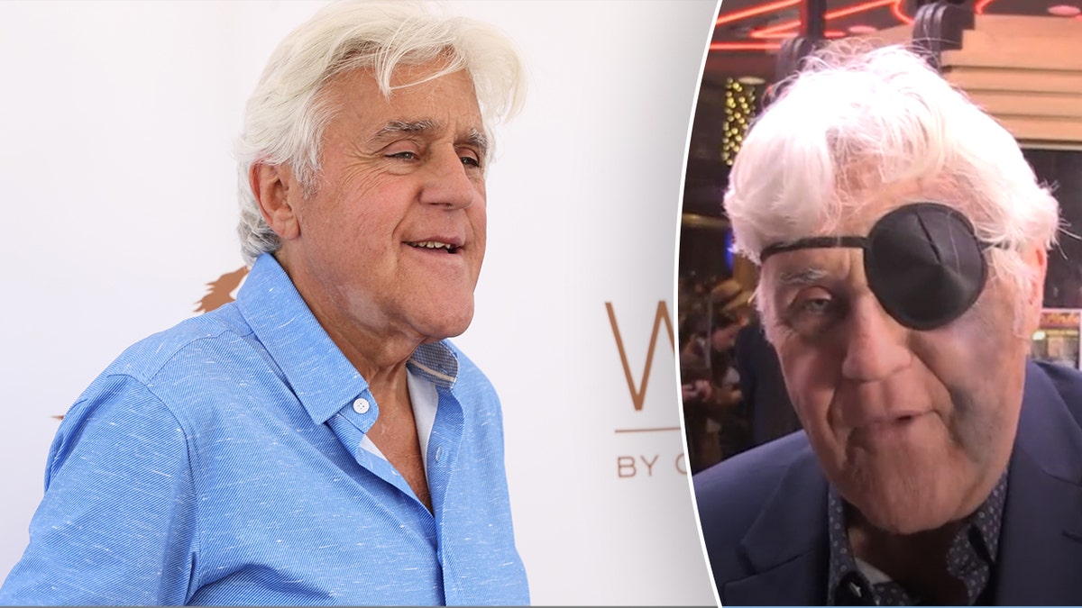 Jay Leno wears an eye patch