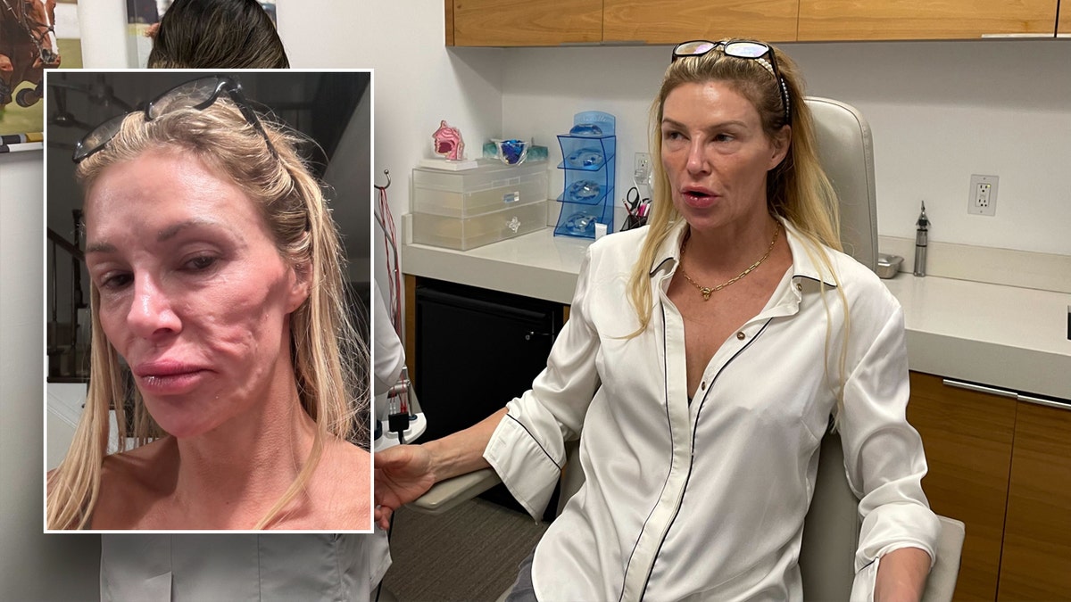 Reality star Brandi Glanville in doctors office