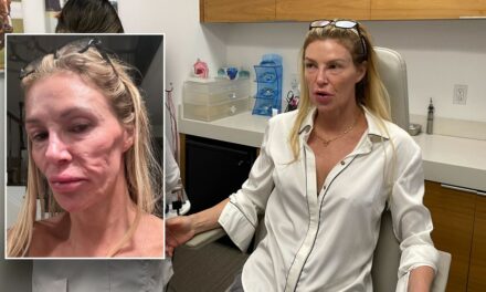 Brandi Glanville thinks parasite attacked face as ‘Botched’ doc Terry Dubrow calls her ‘ticking time bomb’