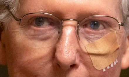 Mitch McConnell Appears Bruised, Bandaged After Latest Fall at Capitol