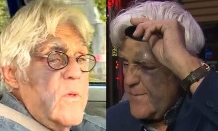 Jay Leno Breaks His Silence To Address Claims His Facial Injuries Stemmed From Being Beaten Up by the Mob