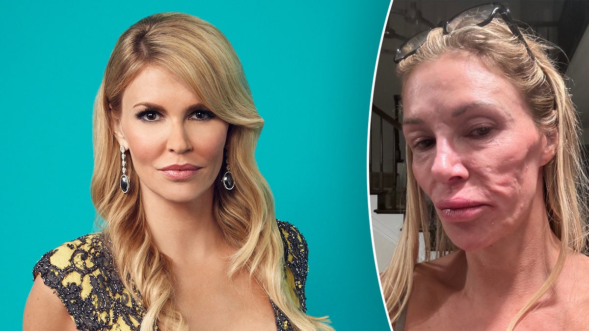 A split image of Brandi Glanville on Real Housewives and now