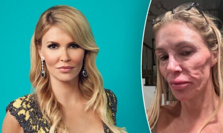 Brandi Glanville shares stripped down photo as she claims her ‘looks are ruined’ by mystery illness