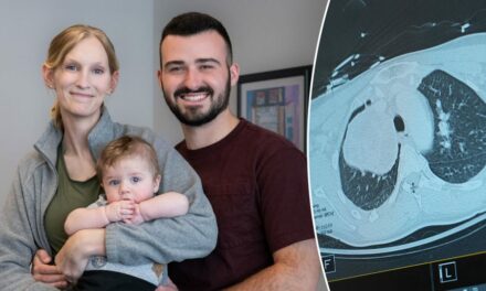 Pregnant woman and baby saved after doctors find grapefruit-sized tumor: ‘Extremely rare’