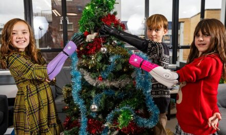 ‘Best Christmas gift’ ever as kids with missing limbs receive bionic arms: ‘Amazing’